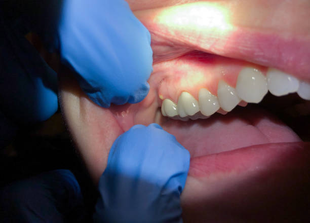 Best Mobile Emergency Dentist in Ruthers, CA
