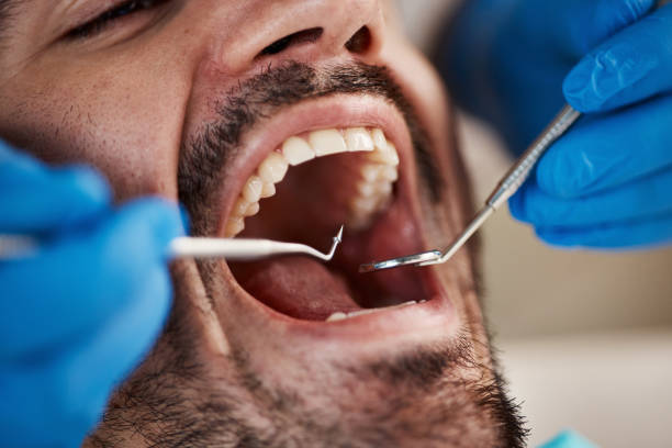 Best Emergency Dental Care for Abscessed Tooth in Ruthers, CA