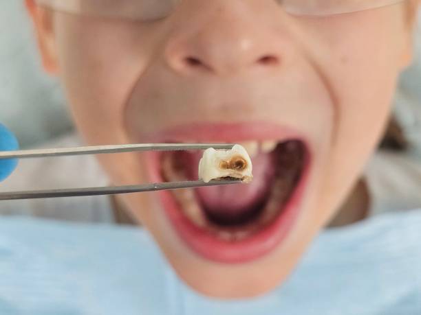 Best Weekend Emergency Dentist in Ruthers, CA