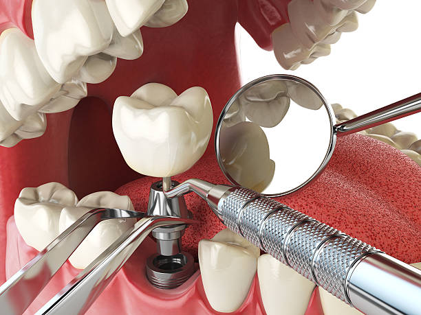 Best Holiday Emergency Dentist in Ruthers, CA